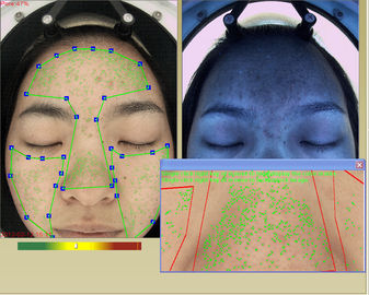 Analisis Kulit Portabel Kosmetik dan Terapis Kulit Dermis Layer Detect