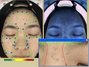 Kosmetik Menggunakan Mesin Analisis Kerut 3D Spectrum RGB + UV + PL 3