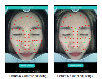 Medical 3D Skin Analyzer Sistem Analisis Wajah Digital Bersertifikat CE