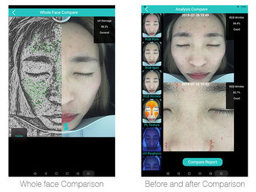 3d Moisture Portable Facial Skin Analyzer Machine / Skin Hydration Analyzer