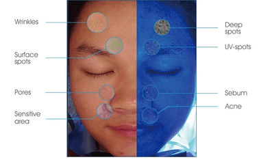 RGB PL UV Light Skin Hydration Analyzer Untuk Deteksi Masalah Kulit