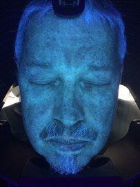 Mesin Diagnosis Pemindai Kulit, Analisis Kulit 3D Uv