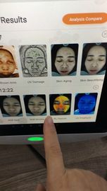 Therapist Smart Skin Analyzer Mendeteksi Masalah Kulit Dalam Ce Sertifikat