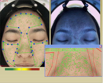Profesional 3d Facial Hydration Analyzer Kulit Mesin Dengan Layar Sentuh