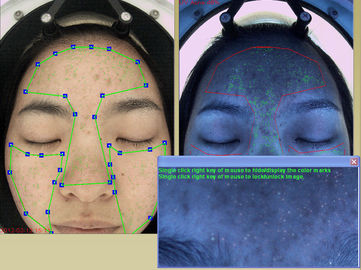 Moisture Analyzer Face Camera 20Mega Pixel Sertifikat FCC