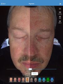 Facial 3d Skin Analyzer Scanner Visia 32GB Penyimpanan Untuk Klinik Kulit Dokter