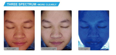 Pdf Print Portable Skin Analyzer Face Camera Untuk Klinik Dokter