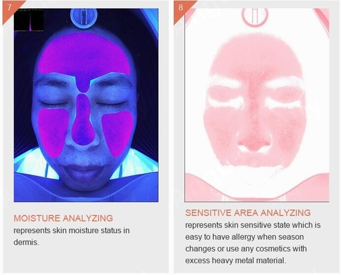 Perawatan Kulit Kerut Pigmentasi Mesin Penganalisis Kulit Jerawat Kuis Cerdas 3D