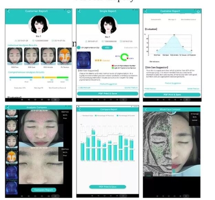 Kamera Wajah Penganalisis Hidrasi Kulit Profesional Layar 10,4 inci 20MP