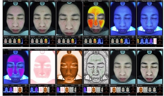 RGB UV PL Smart Skin Analyzer