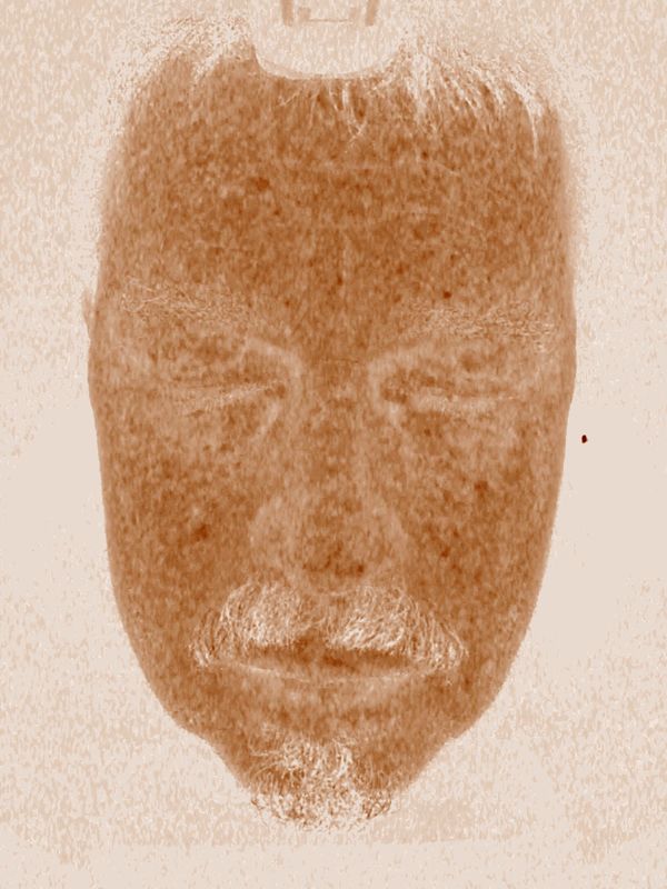 Sistem Analisis Pemindai Kulit Definisi Tinggi 5d, Alat Analisis Kulit Sensitif Untuk Salone Spa