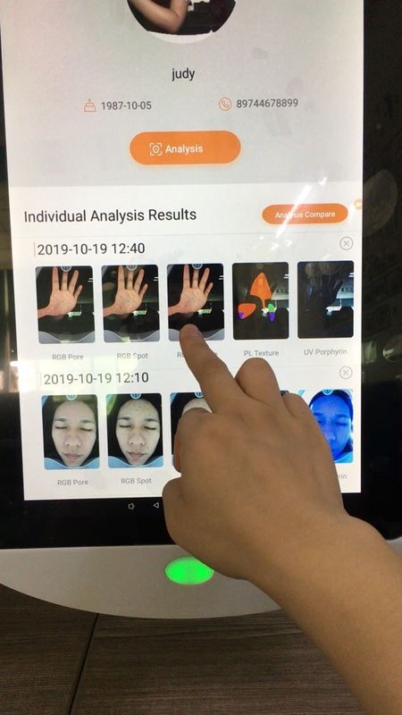 Sistem Analisis Wajah Korea Penyimpanan Digital 64GB Untuk Klinik Dokter