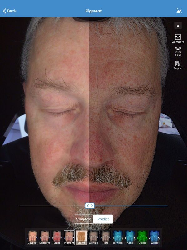 Facial 3d Skin Analyzer Scanner Visia 32GB Penyimpanan Untuk Klinik Kulit Dokter